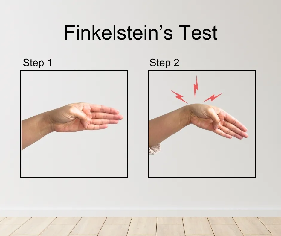Finkelstein test